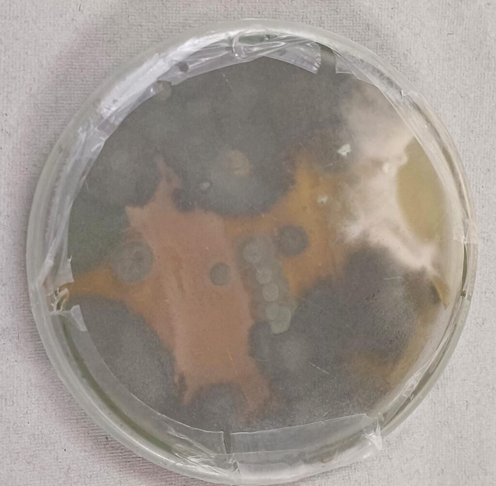 Before treatment evidence