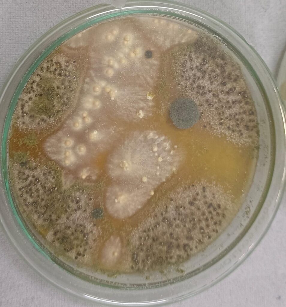 Before treatment evidence