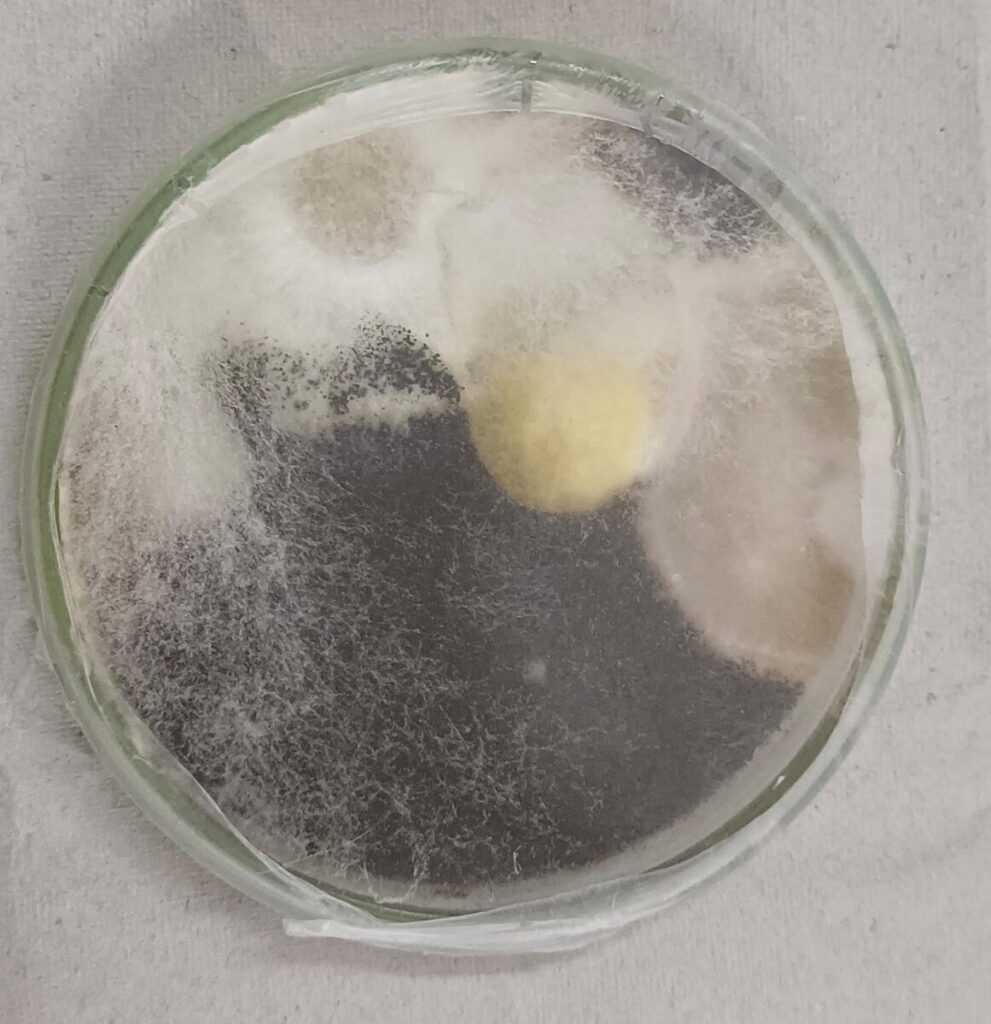 Before treatment evidence